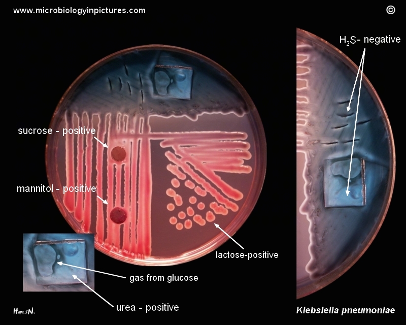 Klebsiella pneumoniae, positive tests